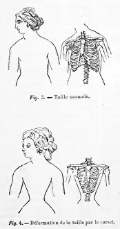 Corsets Prints: Effect of Corsets
