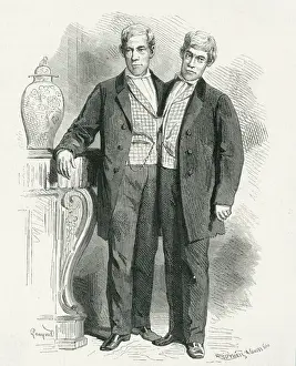 Eng and Chang, Siamese twins