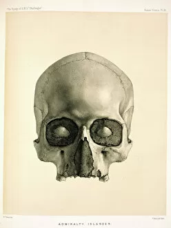 Bone Collection: Engraving of a human skull