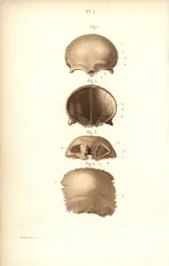 Corbie Prints: Frontal bones of the skull
