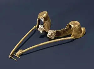 Spitalfields Prints: A gold lower denture