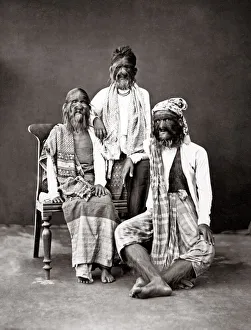 Ethnicity Prints: The Hairy Family of Burma - hypertrichosis lanuginosa