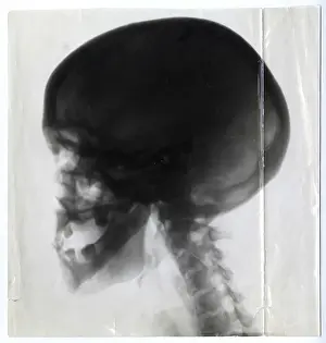 Involved Prints: Harry Prices investigations into the mediumship of Duncan