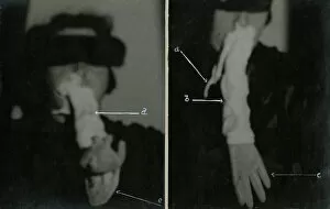 Blindfold Collection: Helen Duncan - Ectoplasm & Teleplasmic hand