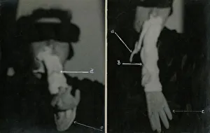Sance Gallery: Helen Duncan - Ectoplasm & Teleplasmic hand