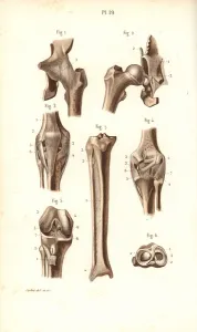 Masse Prints: Hip joint and thigh bones
