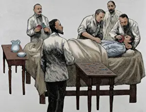 Operation Prints: History of medicine. Chloroform anesthesia. Engraving, 19th