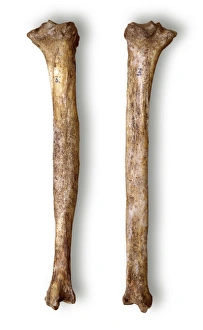 Tibia Collection: Homo sapiens tibia