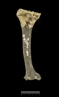 Humerus of Achondroplastic Dwarf