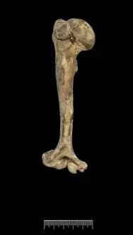 Humerus of Achondroplastic Dwarf