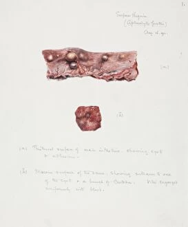 Illustration of a seal intestine