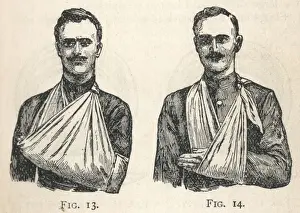 Sling Prints: Illustrations of large and small arm slings