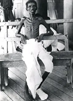 Skeletal Prints: Indian soldier after the Siege of Kut, WW1