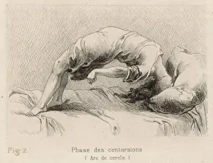 Insanity / Hysteria / 1881