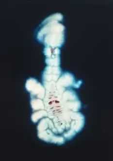 Scorpion Prints: Kirlian Scorpion