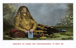 HAIRY MAN