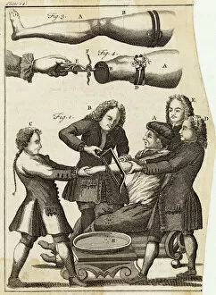 1739 Gallery: Medical / Amputation / Arm