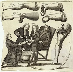 Amputation Gallery: Medical / Amputation / Leg