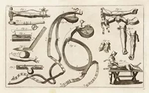 Blood Collection: Medical / Instruments / 1739