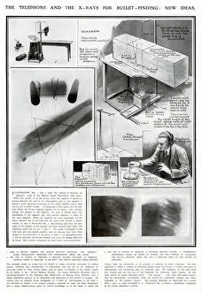 Images Dated 18th March 2021: New Ideas for using X-Rays for Medical use WWI