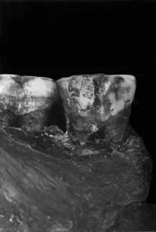 Forgery Prints: Piltdown 1 molars
