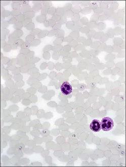 Protozoan Collection: Plasmodium sp. malarial parasite