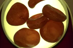 Sickle Prints: Red blood cells