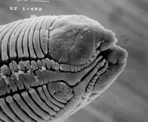 Microscope Image Gallery: Roundworm