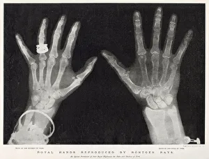 X Rays Prints: Royal Hands Reproduced by Rontgen Rays
