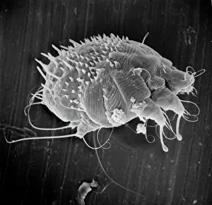 Acarina Gallery: Sarcoptes scabiei, scabies mite