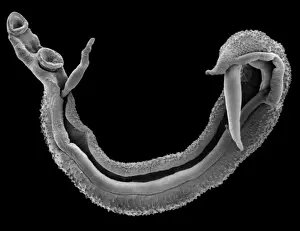 Magnified Prints: Schistosoma spp. blood fluke