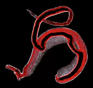 Mammalia Gallery: Schistosoma spp. blood flukes