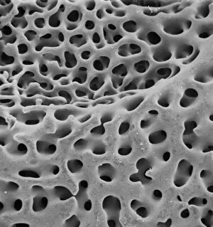 Microscope Image Collection: SEM of echinoderm steroem