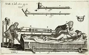 Surgery Collection: Setting a Bone 1682