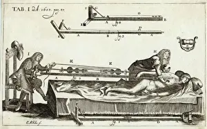 Surgery Prints: Setting a Bone 1682
