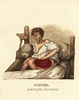 Wounds Prints: A ship's boy with a case of necrotizing fasciitis