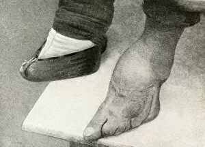 Images Dated 23rd August 2018: Shocking result of binding girls feet, China, East Asia