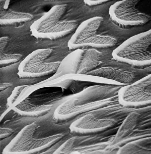 Snail teeth
