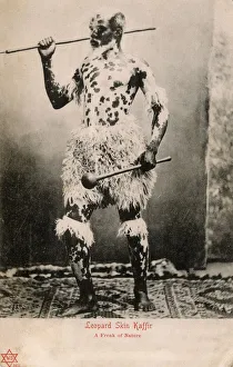 Images Dated 16th May 2018: A South African Man with skin pigmentation condition