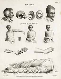 Surgical procedures from the 19th century