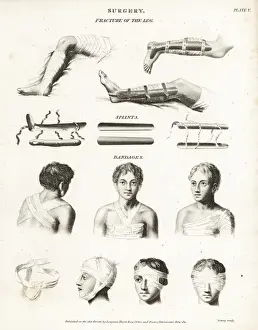 Surgical procedures from the 19th century