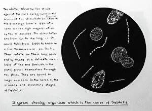 Syphilis Prints: The Syphilis organism, 1920s projection slide