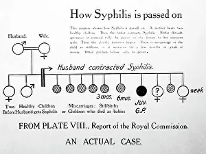 How syphilis is passed on, 1920s projection slide