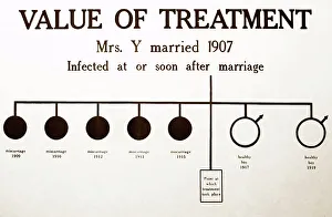 Syphilis treatment, 1920s projection slide