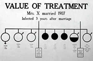 Syphilis treatment, 1920s projection slide