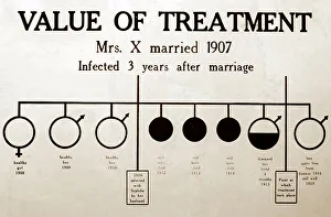 Syphilis treatment, 1920s projection slide