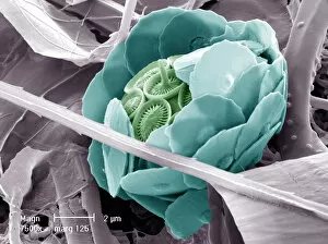 Scanning Electron Micrograph Collection: Syracosphaera anthos
