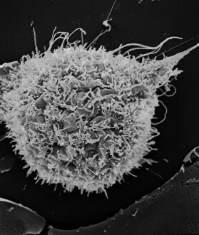 Scanning Electron Microscope Collection: T2 cell culture