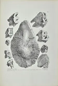 Artefacts Prints: Teeth and bony base of the nose of Rhinoceros, Kent's Cavern