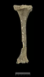 Egypt Collection: Tibia of Achondroplastic Dwarf
